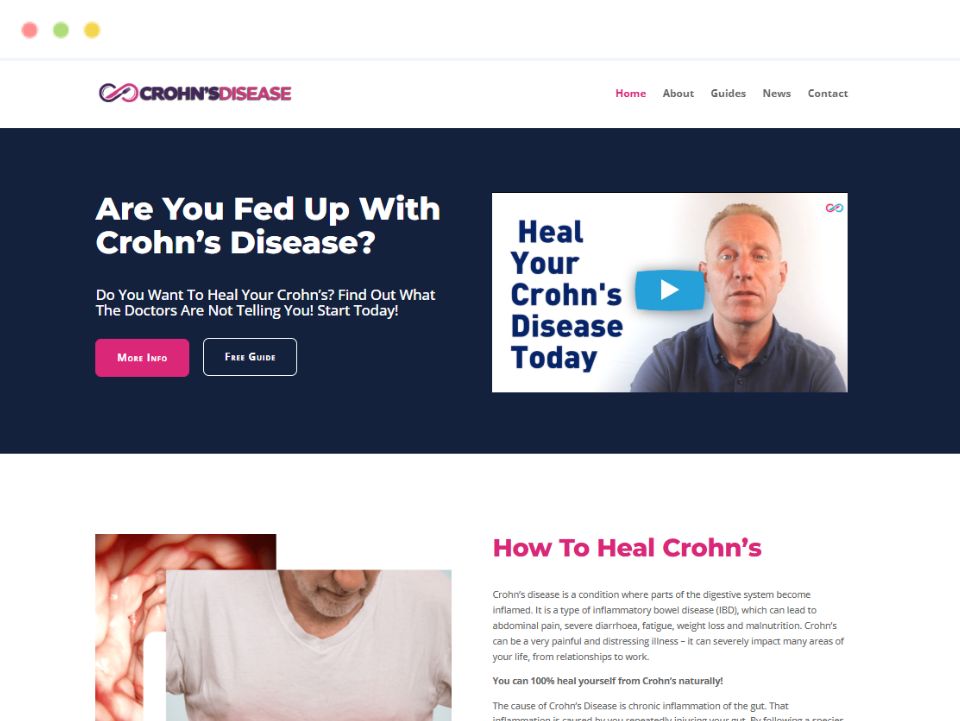 crohns-disease-webpage