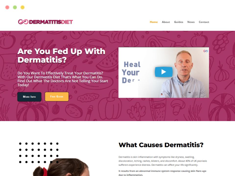 dermatitis-diet-webpage