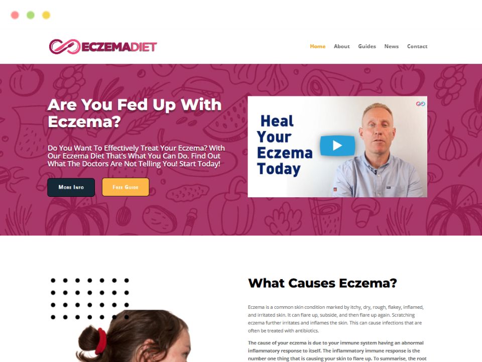 eczema-diet-webpage