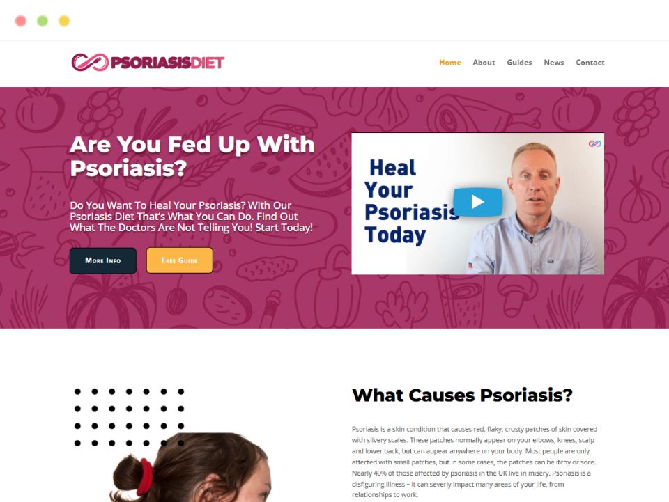 psoriasis-diet-webpage