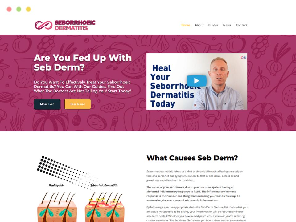 sebderm-webpage