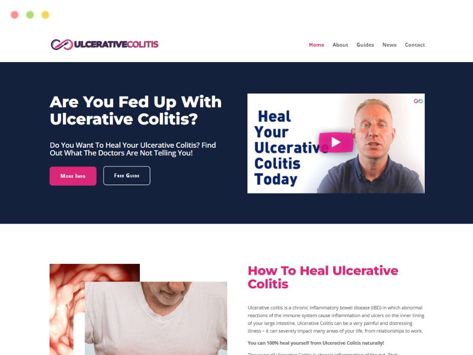 ulcerativecolitis-webpage