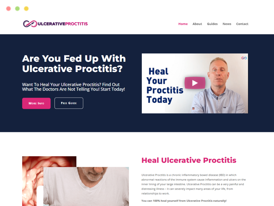 webpage-ulcerative-proctitis